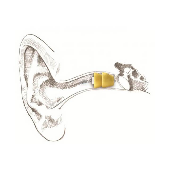 invisible hearing aids